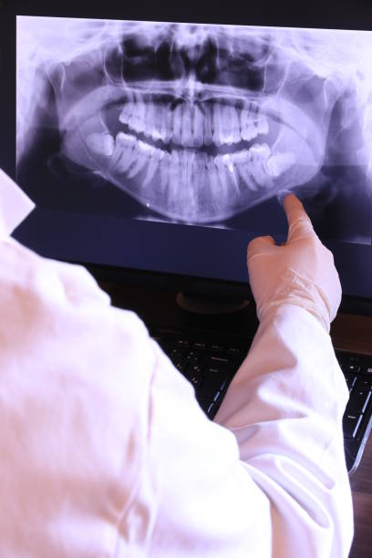 Best Emergency Dentist for Knocked-Out Tooth in East Porterville, CA